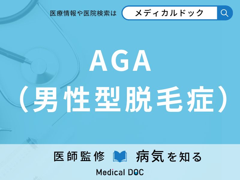 AGA(男性型脱毛症)