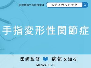 手指変形性関節症