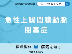 急性上腸間膜動脈閉塞症
