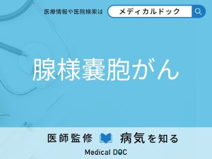 腺様嚢胞がん
