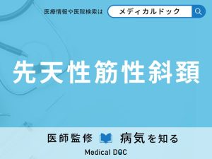 先天性筋性斜頚