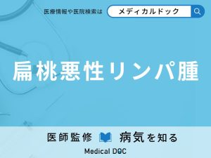 扁桃悪性リンパ腫