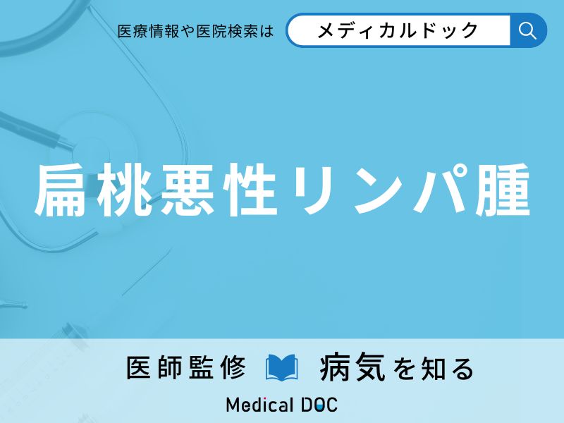 扁桃悪性リンパ腫