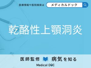 乾酪性上顎洞炎