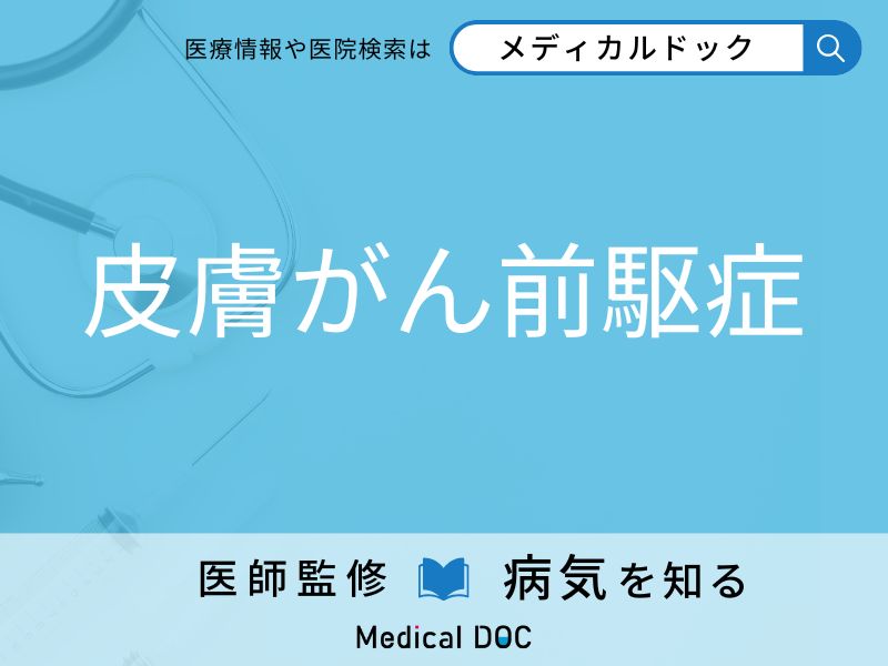 皮膚がん前駆症