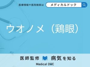 ウオノメ（鶏眼）