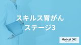 女性に多い「スキルス胃がん」は”ステージ3”で症状や生存率はどうなる？【医師監修】