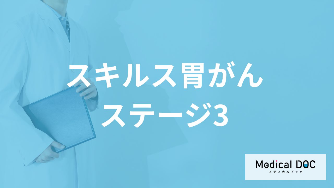 女性に多い「スキルス胃がん」は”ステージ3”に進行しやすい？早期発見のコツも解説！
