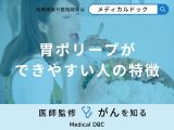 非公開: 「胃ポリープができやすい人の特徴」はご存知ですか？医師が解説！
