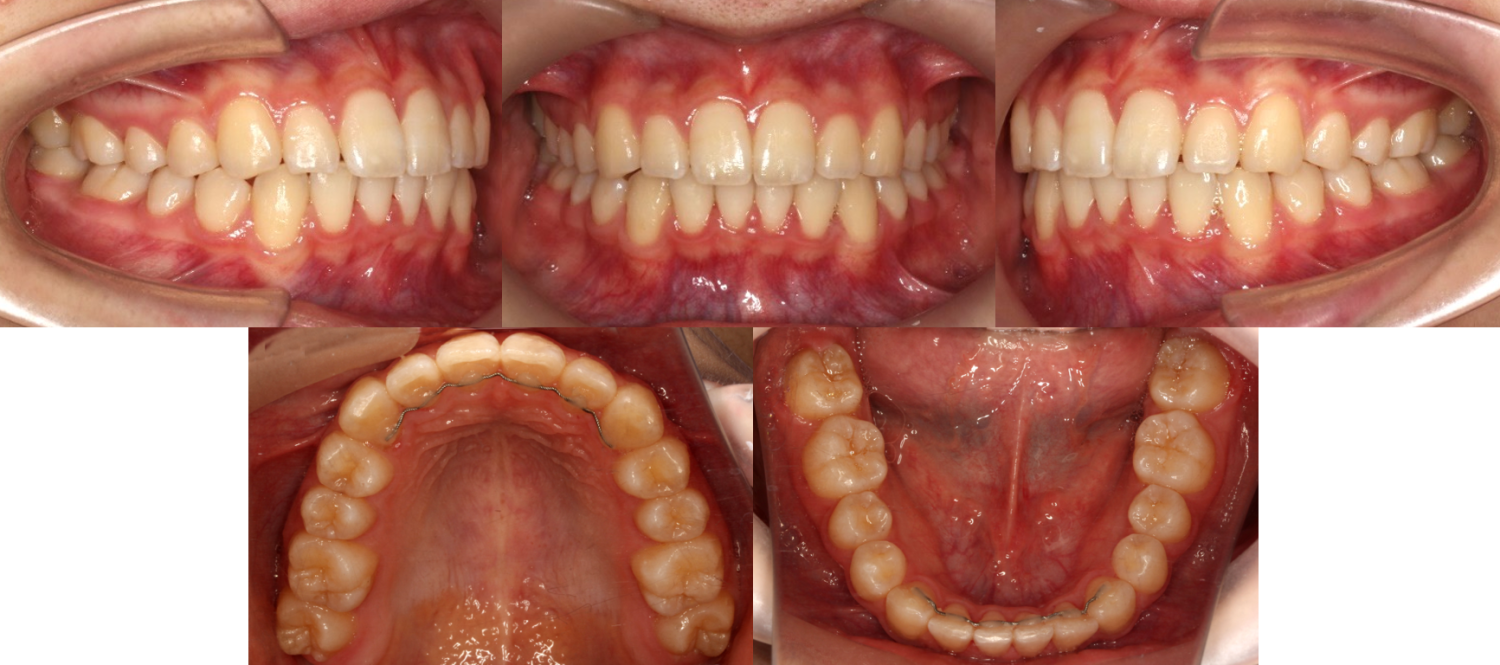 蒲田あさみ矯正歯科