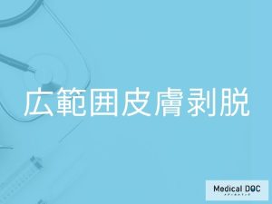 広範囲皮膚剥脱