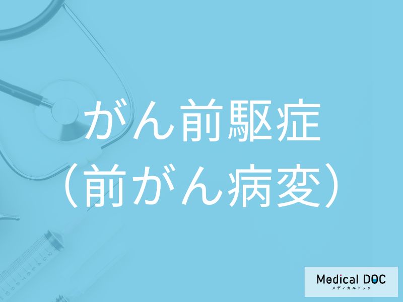 がん前駆症（前がん病変）
