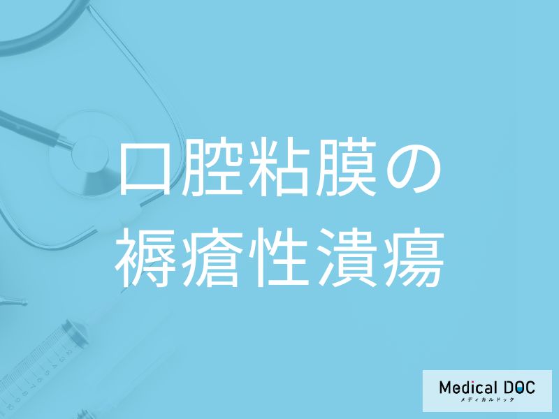 口腔粘膜の褥瘡性潰瘍