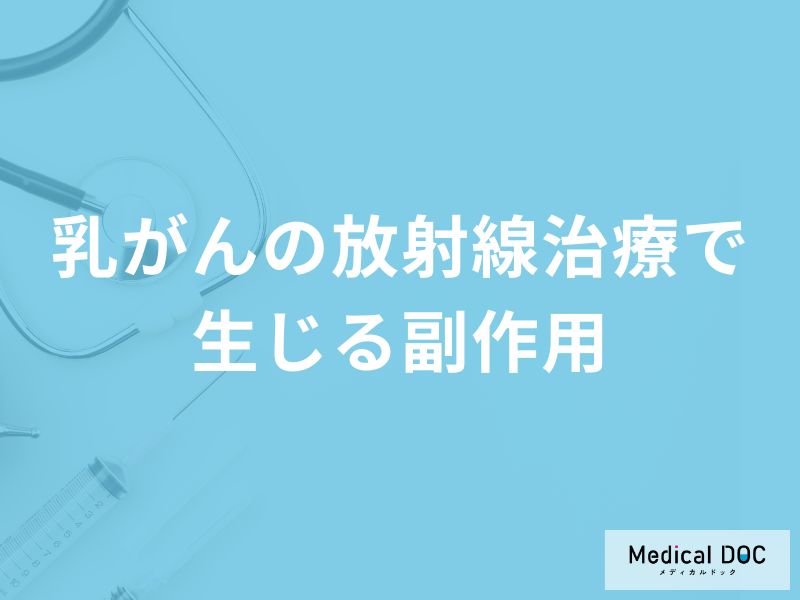 「乳がんの放射線治療で生じる副作用」はご存知ですか？【医師監修】