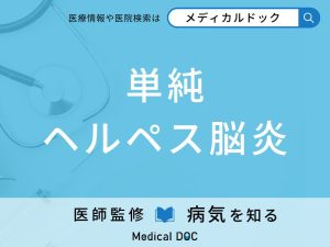 単純ヘルペス脳炎