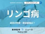 「リンゴ病」が流行中…春から夏にかけて感染拡大、“赤いほっぺ”以外の症状を医師が解説