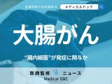 腸内細菌が“がんの引き金”に?「大腸がん」増加の新たな原因が明らかに、若年層にも影響か