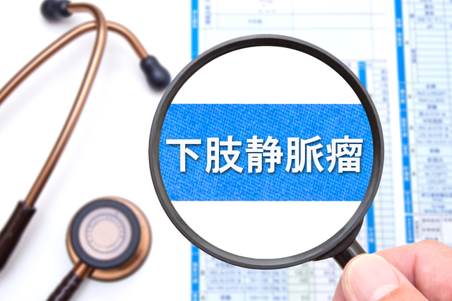 下肢静脈瘤って? 医師が解説