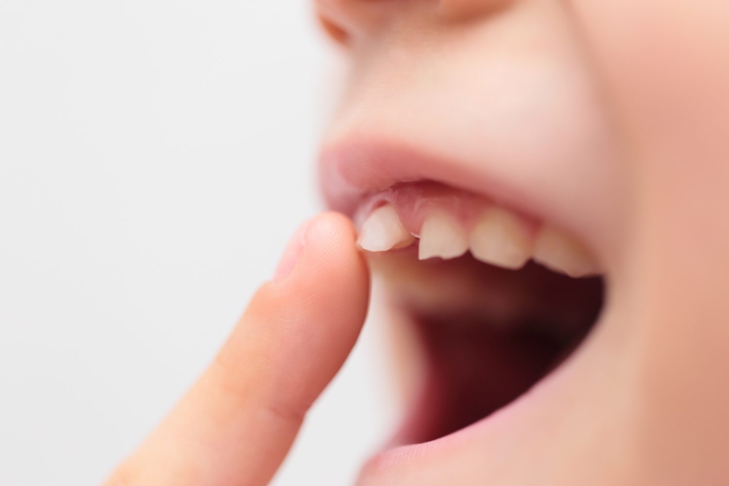 歯科医が教える「子どもの歯並びのための予防的アプローチ」