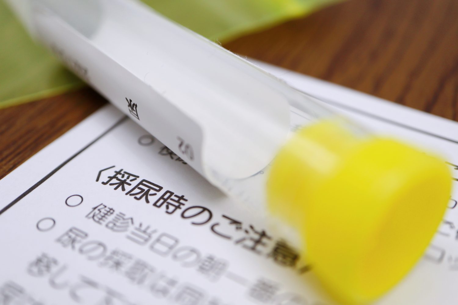 性病検査はどんなことをするのか?