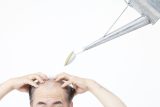 【薄毛に悩む方へ】「植毛治療」と「AGA治療薬」どちらを受けるべきか医師が解説