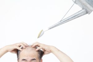 【薄毛に悩む方へ】「植毛治療」と「AGA治療薬」どちらを受けるべきか医師が解説