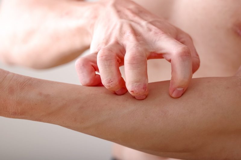 腕をかきむしる男性