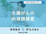 非公開: 「大腸がんの内視鏡検査」はどんな検査をするの？【医師監修】