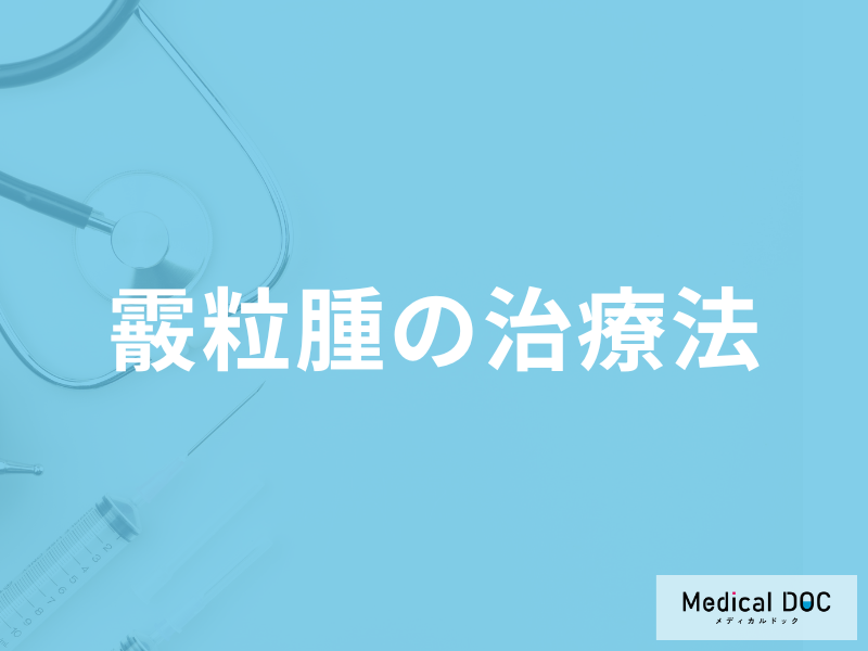 まぶたが腫れる「霰粒腫の効果的な治療法」はご存じですか？予防法も解説！