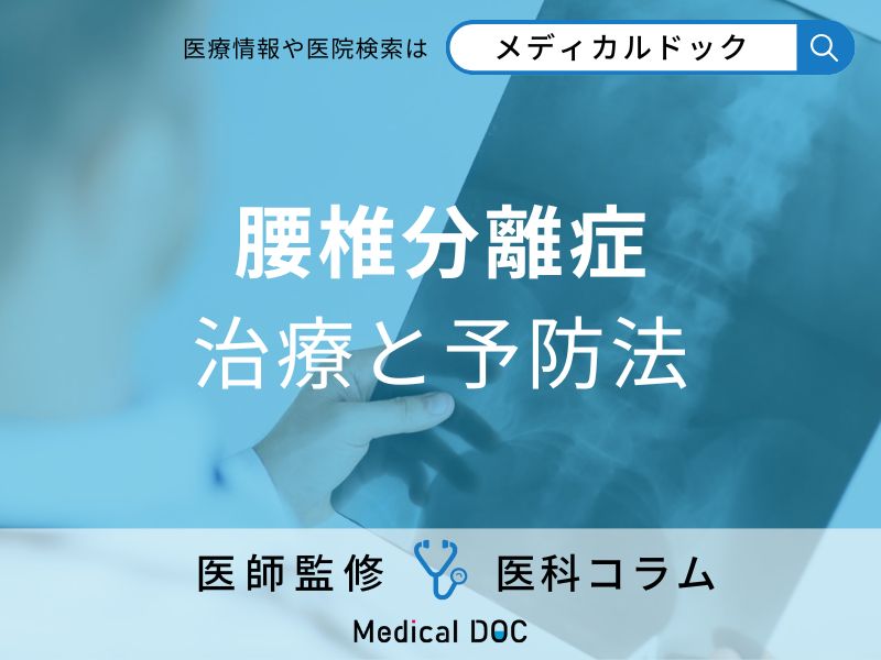 腰椎分離症の治療と予防法