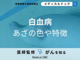 「白血病」を疑う「あざの色」はご存知ですか？あざができやすい部位も解説！
