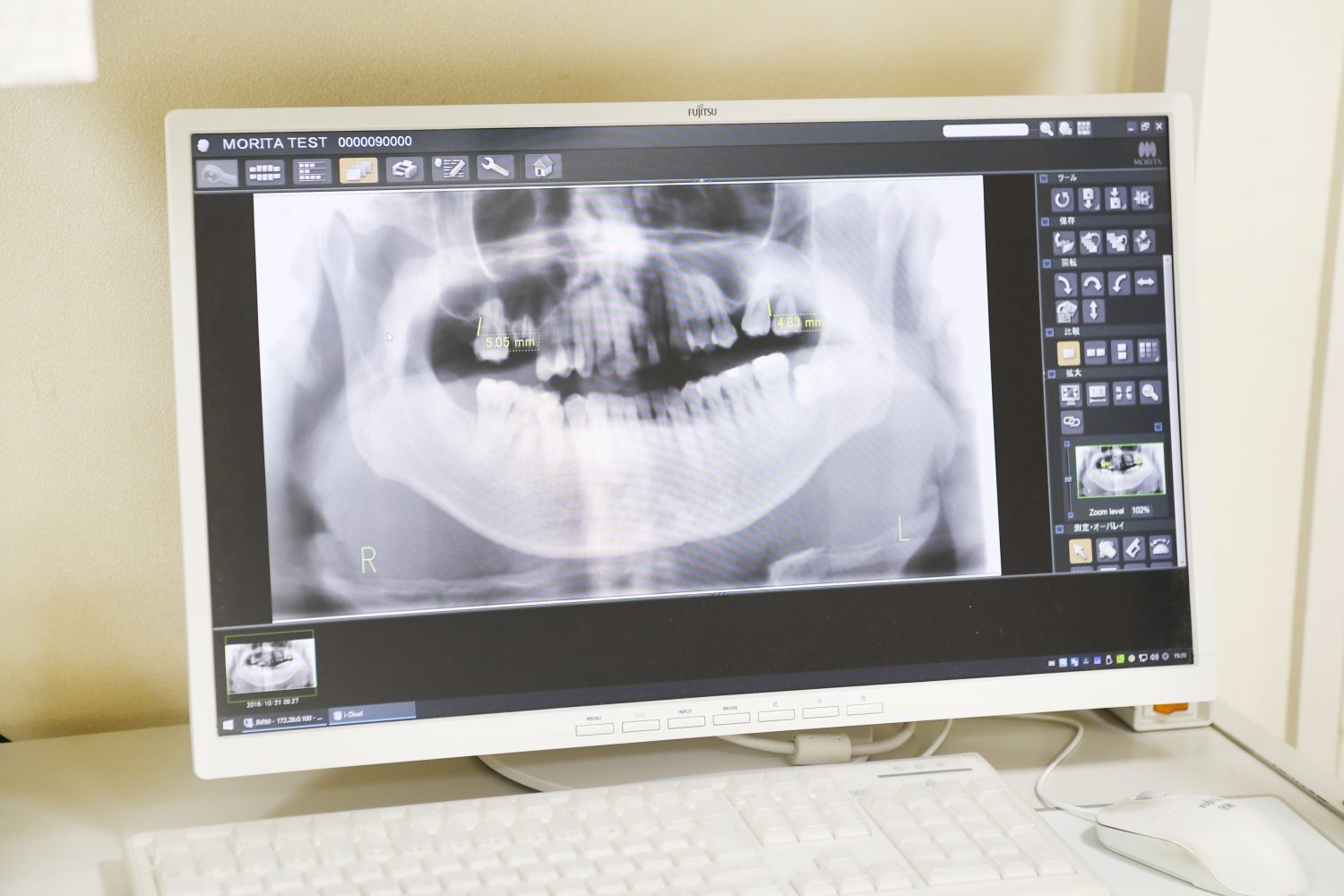 いのうえ歯科photo