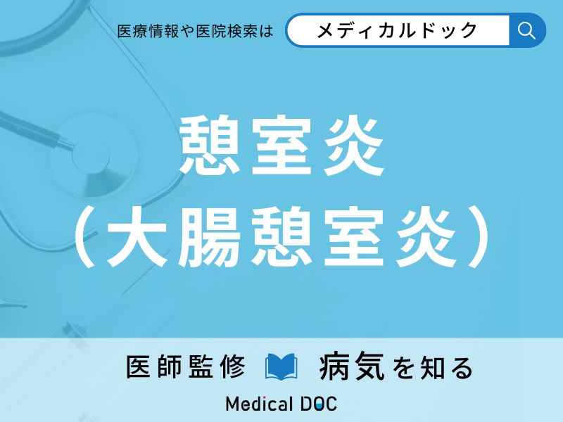 憩室炎（大腸憩室炎）