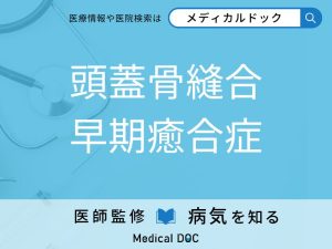 頭蓋骨縫合早期癒合症