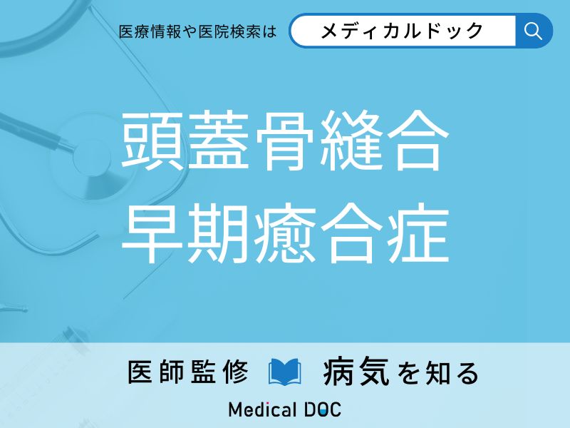 頭蓋骨縫合早期癒合症