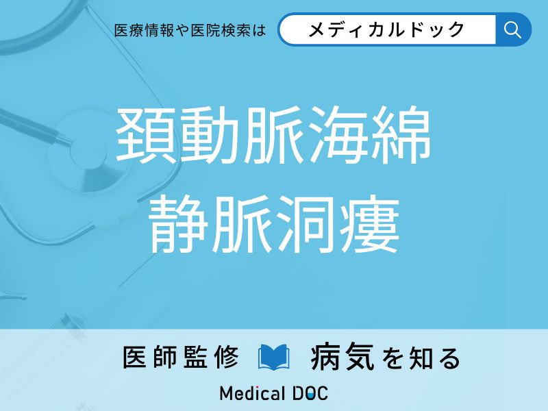 頚動脈海綿静脈洞瘻