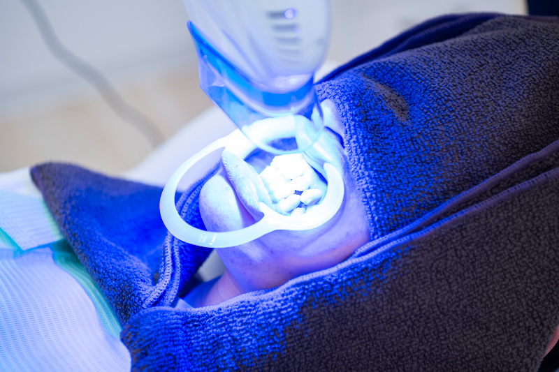 ホワイトニングの歯医者さん　横浜インペリアルトパーズphoto