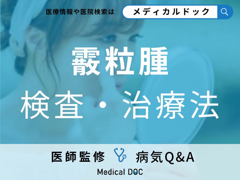 まぶたに硬いしこりができる「霰粒腫(さんりゅうしゅ)」とは?検査や治療についても解説!