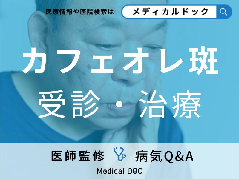 「カフェオレ斑(茶色のあざ)」で受診の目安となる症状とは?治療法についても医師が解説!