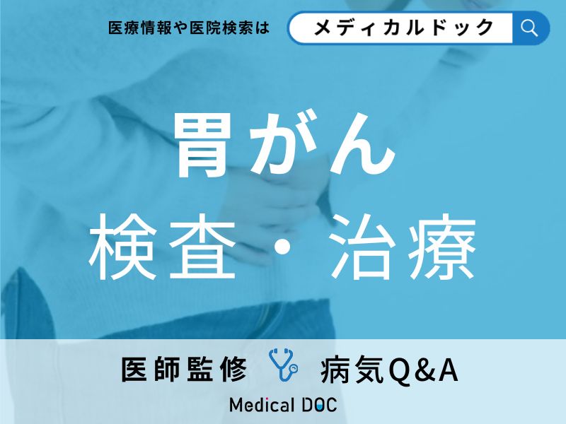 「胃がん」の検査法をご存じですか?治療法について解説!【医師監修】