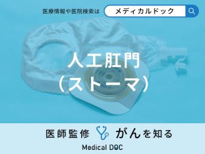 「人工肛門（ストーマ）」が必要になる病気・疾患はご存知ですか？医師が解説！
