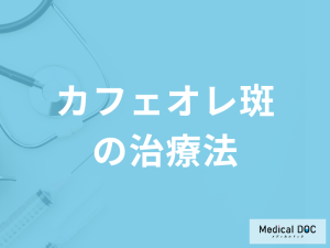 「カフェオレ斑（茶色のあざ）」は色の濃さで『治療』が異なる？放置するリスクも解説！
