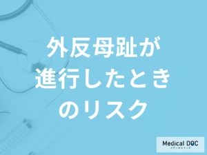 「外反母趾が進行」すると何ができなくなるかご存じですか?予防法を医師が解説！