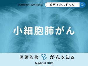 「小細胞肺がん」と「肺がん」の違いとは？発症しやすい人の特徴も医師が徹底解説！