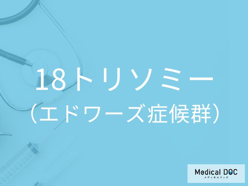 18トリソミー（エドワーズ症候群）