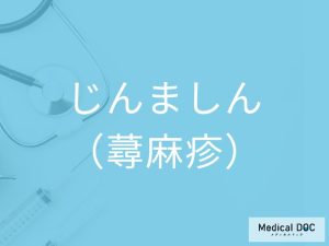 じんましん（蕁麻疹）