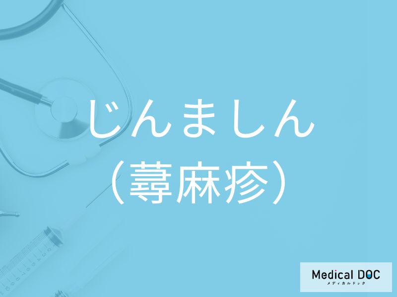 じんましん（蕁麻疹）