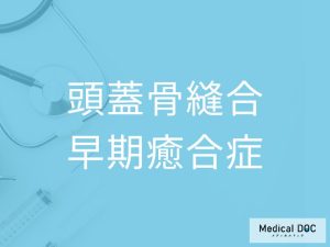 頭蓋骨縫合早期癒合症