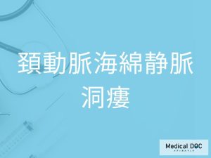 頚動脈海綿静脈洞瘻