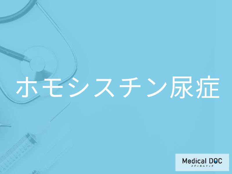 ホモシスチン尿症